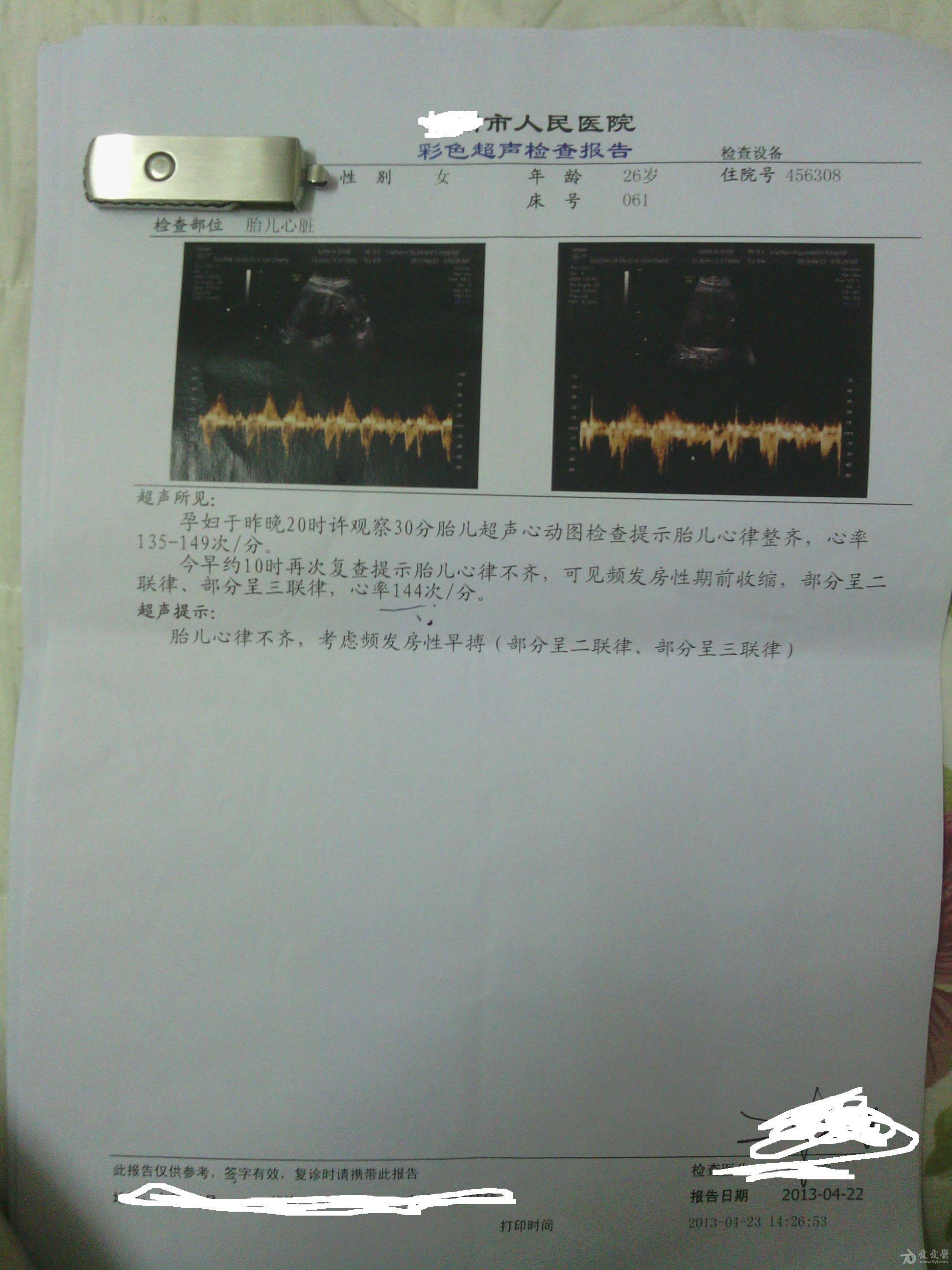 做四维彩超网上预约_如何在网上预约四维彩超_预约四维网上彩超多少钱